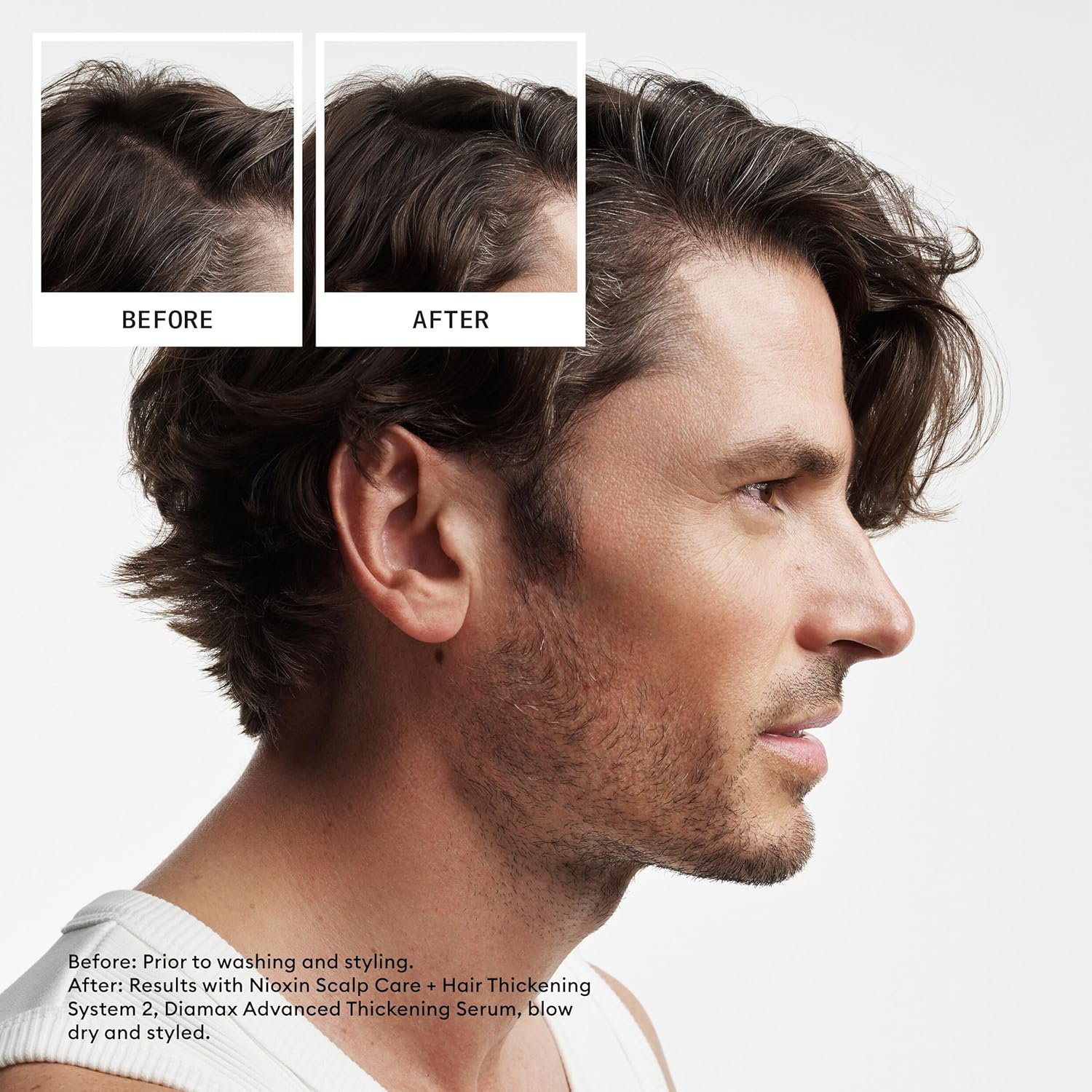 Nioxin System 2 Hair Thickening Kit for Natural Hair with Light Thinning(For Natural Hair with Progressed Thinning)