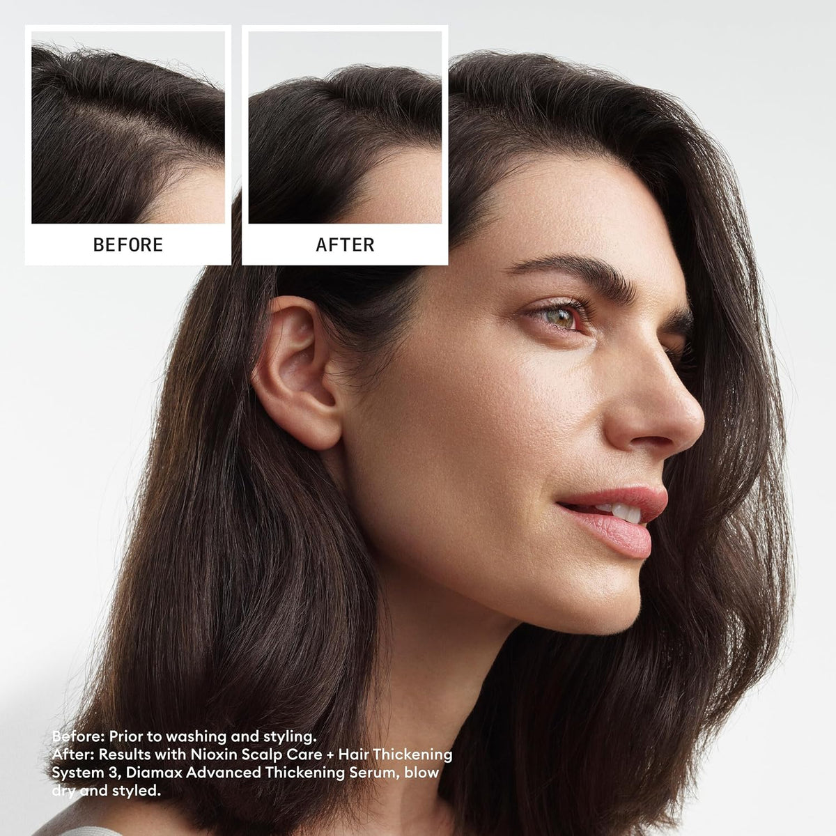 Nioxin Scalp + Hair Shampoo No. 3 - 33.8 Oz
